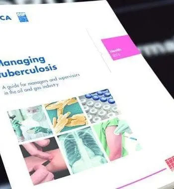 Managing tuberculosis