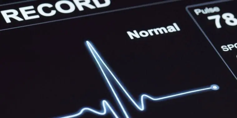 Expatriation: understanding the psychological risks